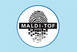 MALDI-TOF-MS